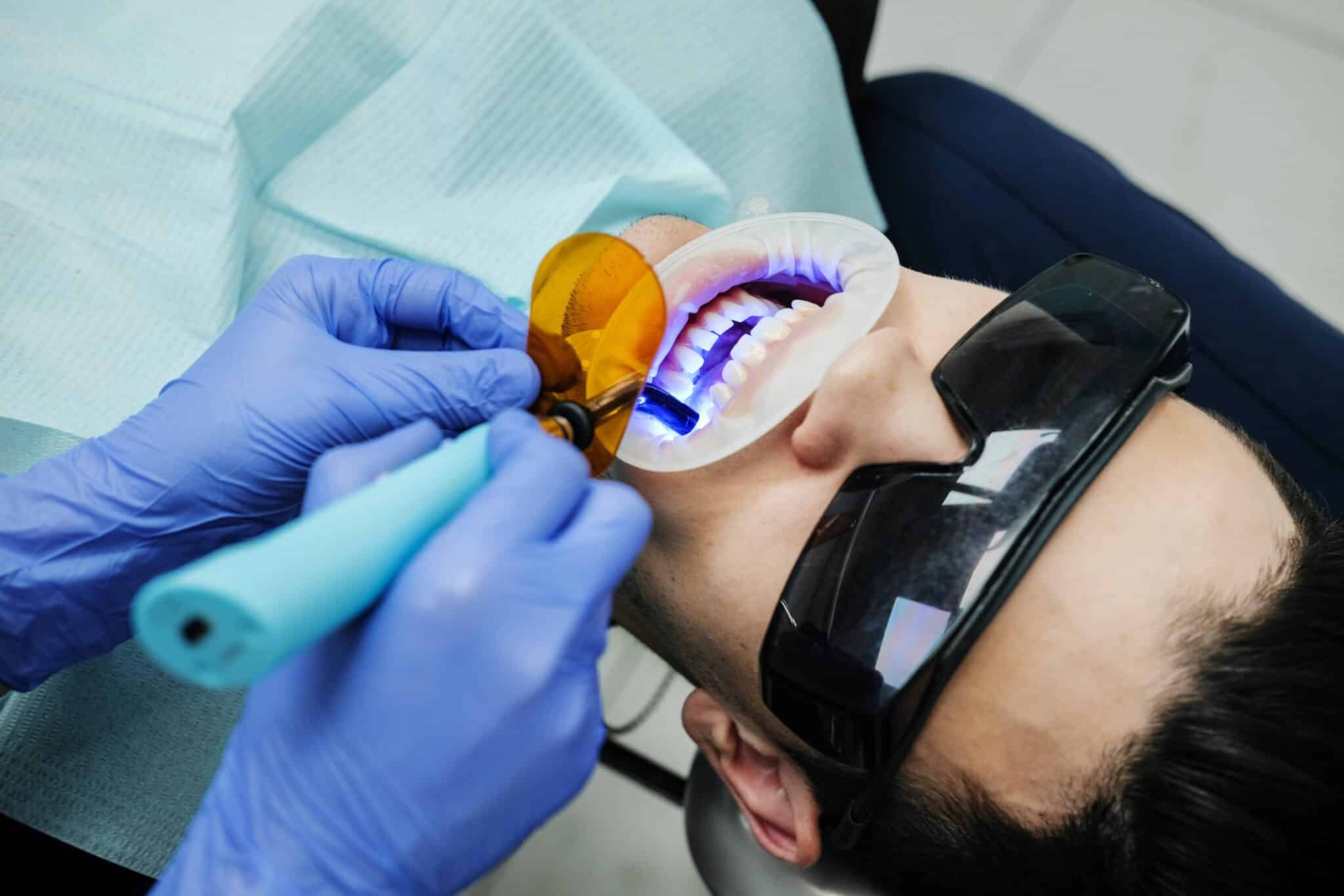 teeth whitening process for Essential Pre-Wedding Grooming Treatments